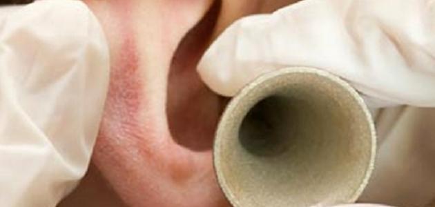 علاج ضعف السمع بالخلايا الجذعية علاج ضعف السمع بالخلايا الجذعية