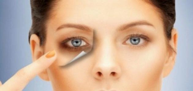 علاج نهائي للهالات السوداء تحت العين علاج نهائي للهالات السوداء تحت العين