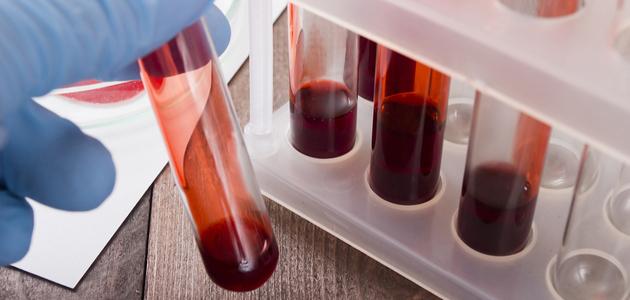 علم أمراض الدم