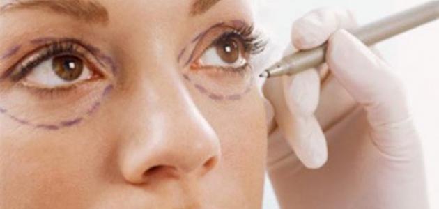 عمليات التجميل وأضرارها عمليات التجميل وأضرارها