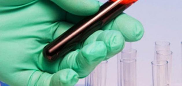 فوائد تحليل الدم فوائد تحليل الدم