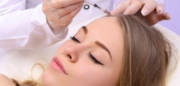 فوائد حقن البلازما للشعر - فيديو