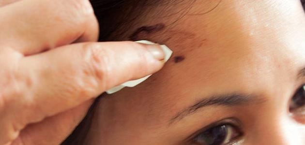 كيفية إزالة صبغة الشعر من الجلد كيفية إزالة صبغة الشعر من الجلد