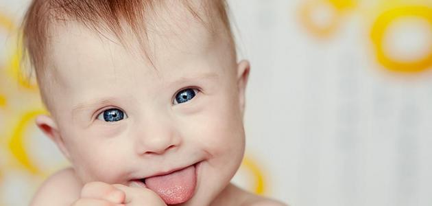 كيفية معرفة الطفل المنغولي