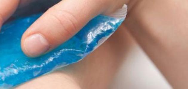 كيف أزيل آثار الكدمات كيف أزيل آثار الكدمات