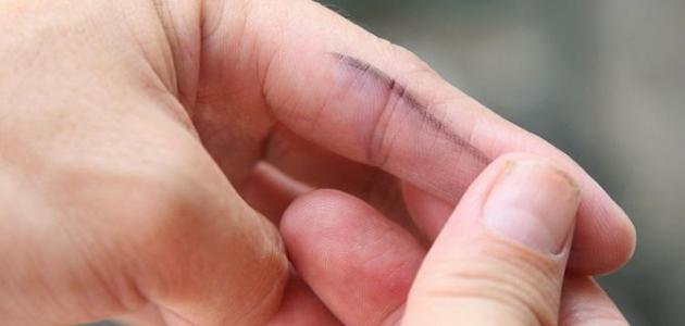 كيف أزيل الحبر عن اليد كيف أزيل الحبر عن اليد