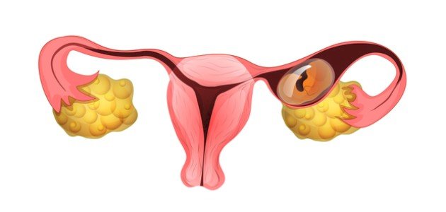 كيف أعرف أن الحمل خارج الرحم كيف أعرف أن الحمل خارج الرحم