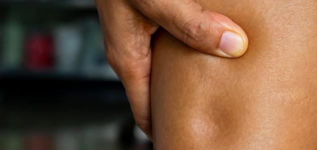 كيف أعرف أن عندي احتباس سوائل كيف أعرف أن عندي احتباس سوائل