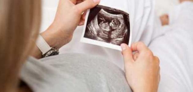 كيف أعرف وضع الجنين من حركته كيف أعرف وضع الجنين من حركته