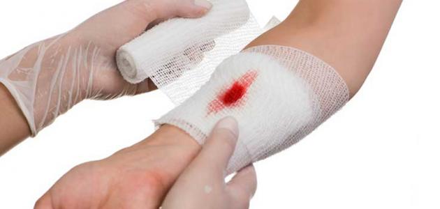 كيف أعقم الجرح كيف أعقم الجرح