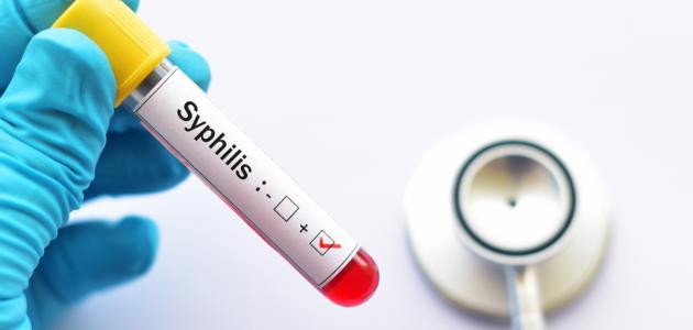 كيف ينتقل مرض الزهري كيف ينتقل مرض الزهري