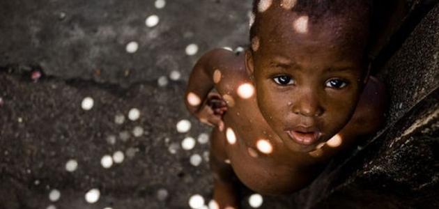 ماذا يسمى فاقد الأب والأم ماذا يسمى فاقد الأب والأم