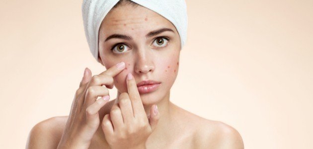 ماسك لحب الشباب سريع المفعول