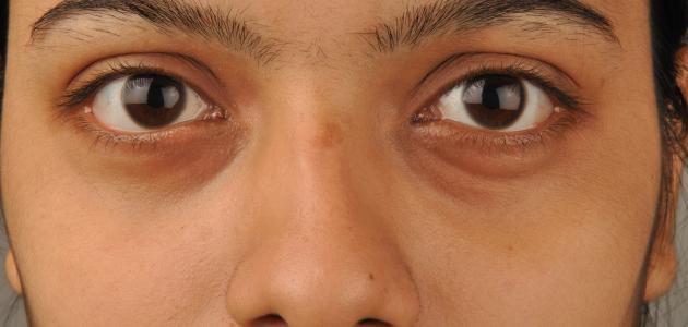 ماسك للهالات السوداء