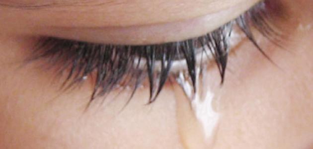 ما أسباب تدميع العين ما أسباب تدميع العين