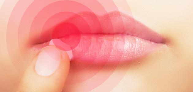 ما أسباب تشقق الشفاه ما أسباب تشقق الشفاه