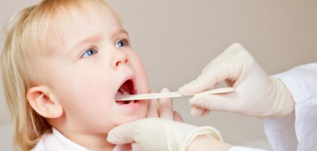 ما سبب احتقان الحلق ما سبب احتقان الحلق