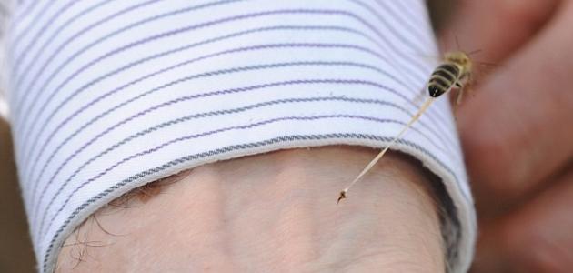 ما علاج قرصة النحل ما علاج قرصة النحل