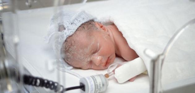 ما معنى أطفال خدج