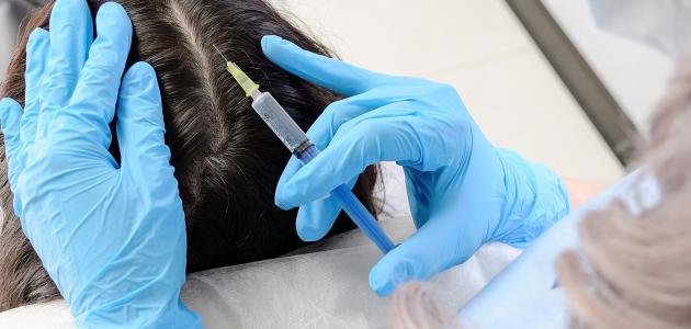 ما هو الميزوثيرابي للشعر ما هو الميزوثيرابي للشعر