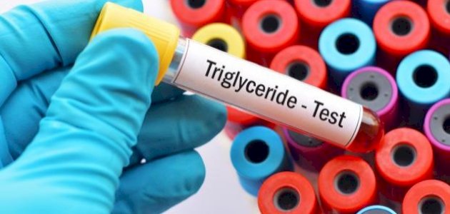 ما هو تحليل الدهون الثلاثية ما هو تحليل الدهون الثلاثية