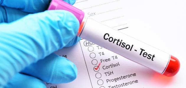 ما هو تحليل الكورتيزول ما هو تحليل الكورتيزول