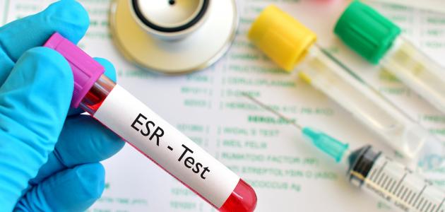 ما هو تحليل ESR ما هو تحليل ESR