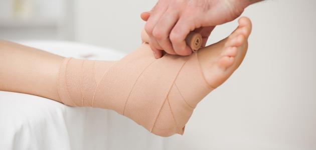 ما هو تمزق الاربطة