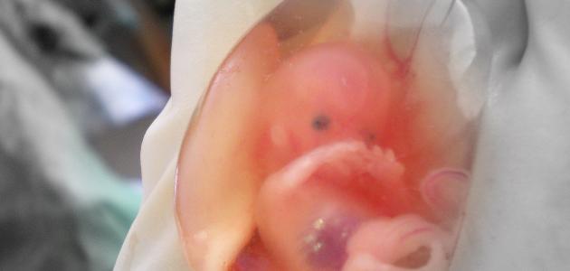 ما هو حكم اجهاض الجنين ما هو حكم اجهاض الجنين