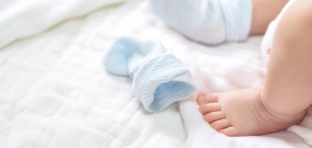 ما هو خلع الولادة ما هو خلع الولادة