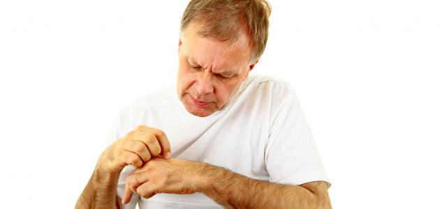 ما هو داء اللؤلؤ ما هو داء اللؤلؤ