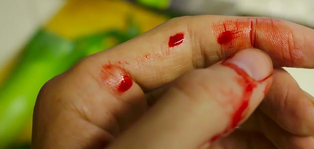 ما هي أسباب النزيف