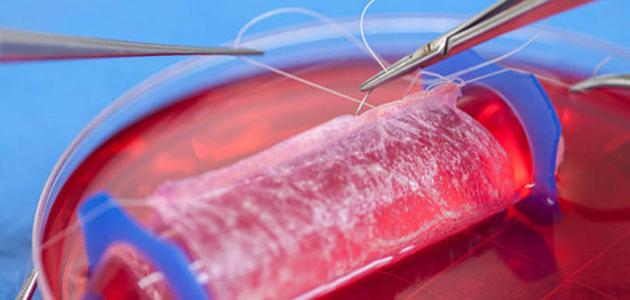 ما هي أعراض تسمم الدم ما هي أعراض تسمم الدم