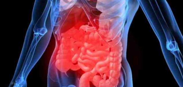 ما هي بكتيريا القولون ما هي بكتيريا القولون