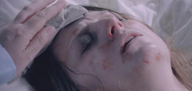 ما هي حمى التيفوئيد