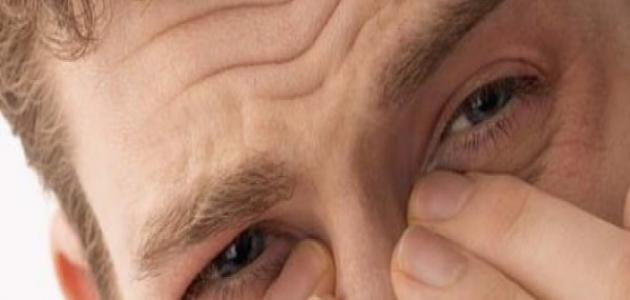 ما هي لحمية الأنف ما هي لحمية الأنف