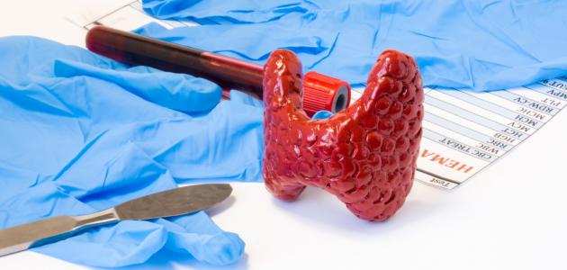 مضاعفات إزالة الغدة الدرقية