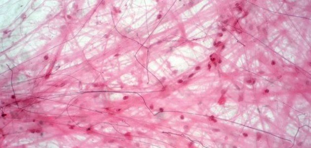 مكونات الأنسجة الضامة مكونات الأنسجة الضامة