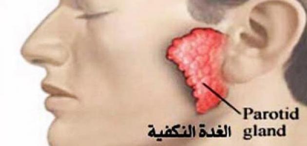 هل التهاب الغدة النكافية معدٍ هل التهاب الغدة النكافية معدٍ