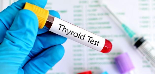 هل تحليل الغدة الدرقية يحتاج إلى صيام هل تحليل الغدة الدرقية يحتاج إلى صيام
