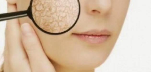 وصفات للوجه الجاف وصفات للوجه الجاف