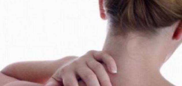 وصفة لإزالة حب الشباب من الظهر