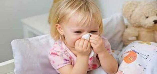 صورة ما هي أعراض الإنفلونزا