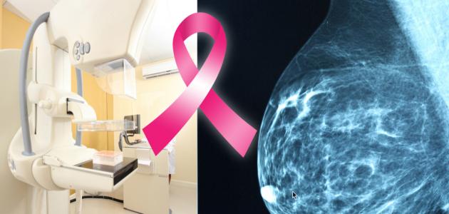 صورة العلاج الإشعاعى لسرطان الثدي
