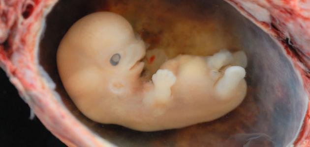 صورة ما أسباب حدوث الحمل خارج الرحم