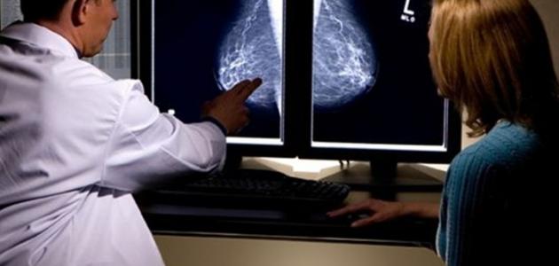 صورة مراحل علاج سرطان الثدي