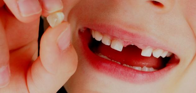 صورة جديد كم عدد الأسنان اللبنية عند الأطفال