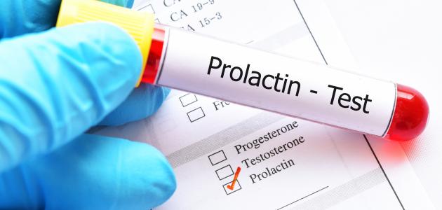 صورة جديد ما هو تحليل Prolactin