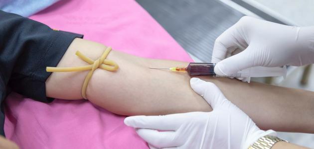 صورة جديد كيفية نقل الدم