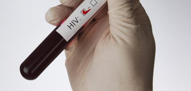 صورة جديد ما هو تحليل HIV